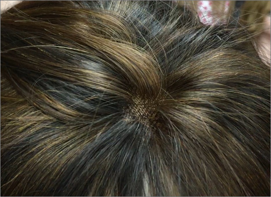 Voluminizador natural PATTY color 2H5 LIGERO