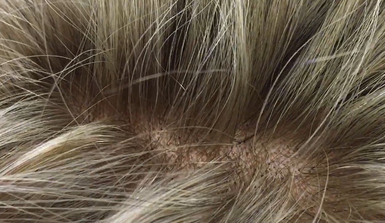 Peluca natural AKILA color 14 TOP TUL transparente efecto piel