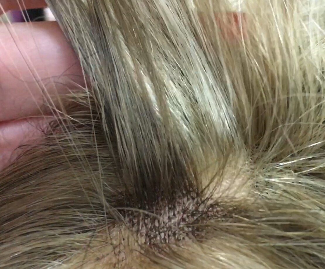 Peluca natural MARTINA  8h613.814 RAYA TUL transparente efecto piel