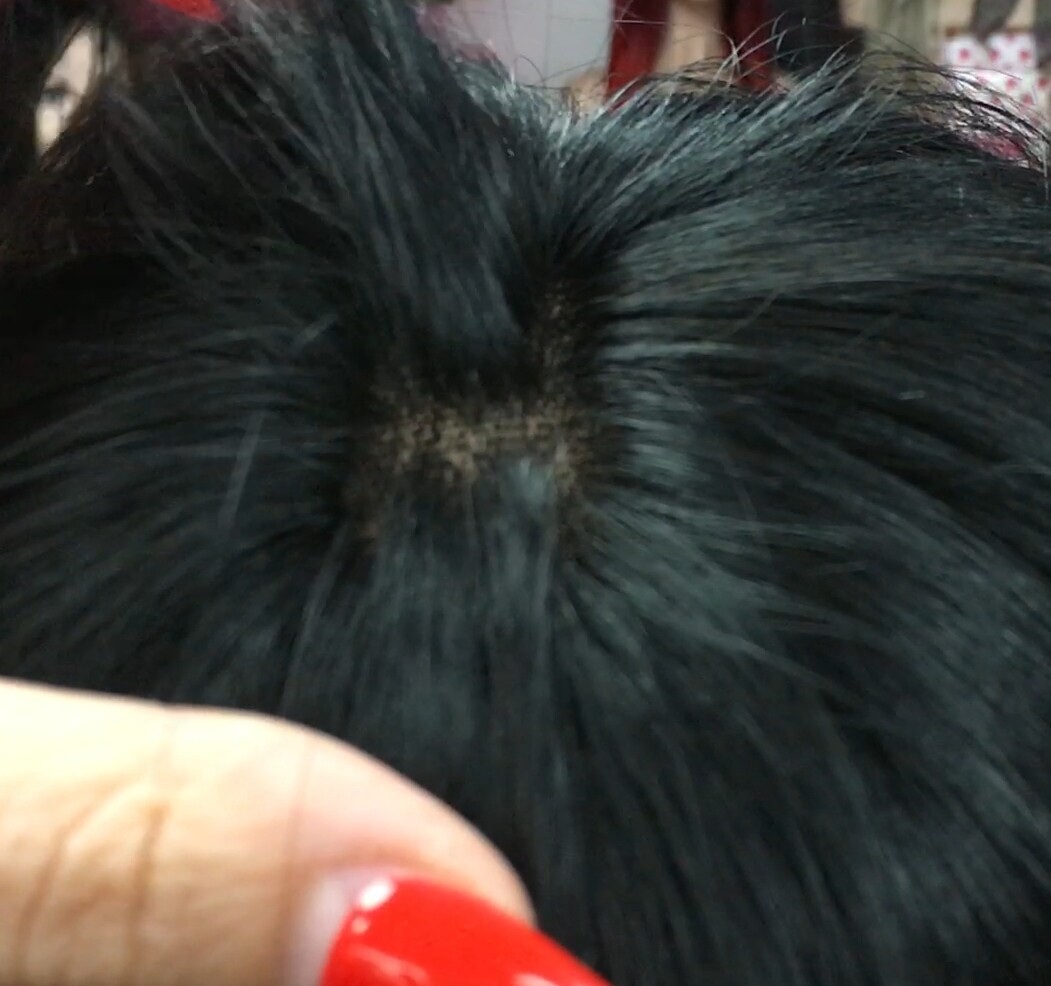 Peluca natural MARTINA color 1 RAYA TUL transparente efecto piel