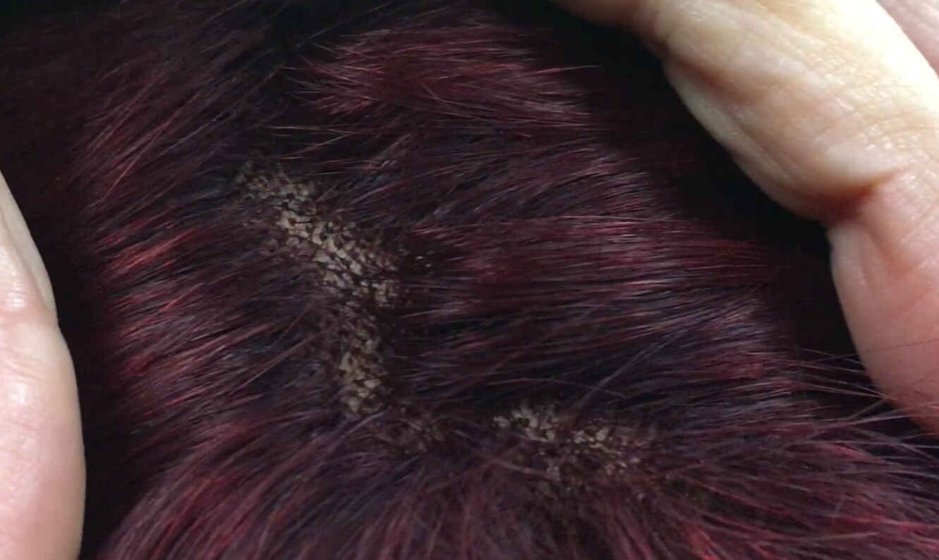 Peluca mediana cabello natural MELANY color 39 BURG tul entero transparente efecto piel