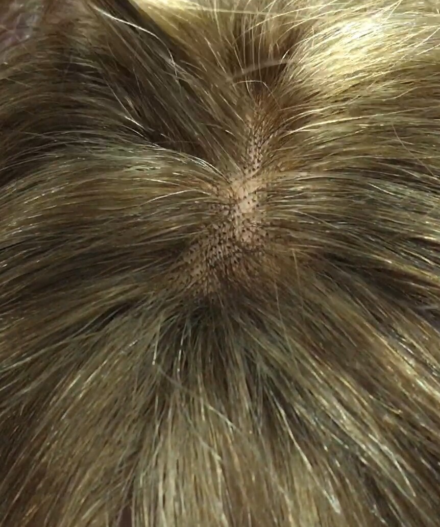 Peluca natural CECI-Ondas color 5H8F10H27 RAYA DE TUL transaprente efecto piel