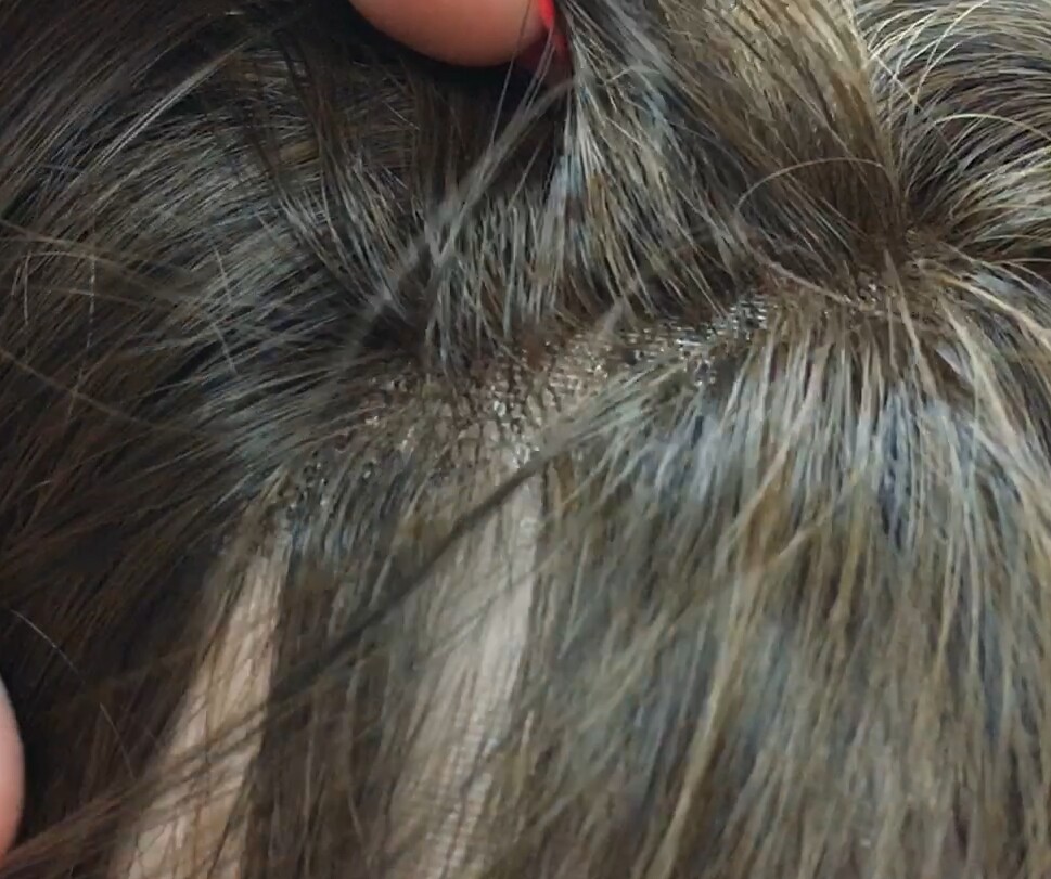 Peluca lace front LISI color 2/30 Star-10 Colageno