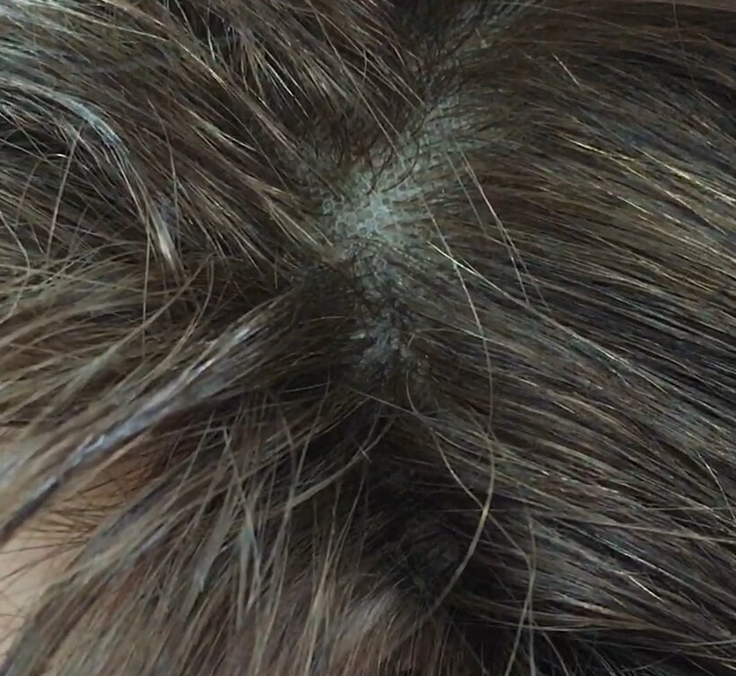 Peluca natural DONA Color 5 Top INYECCIN