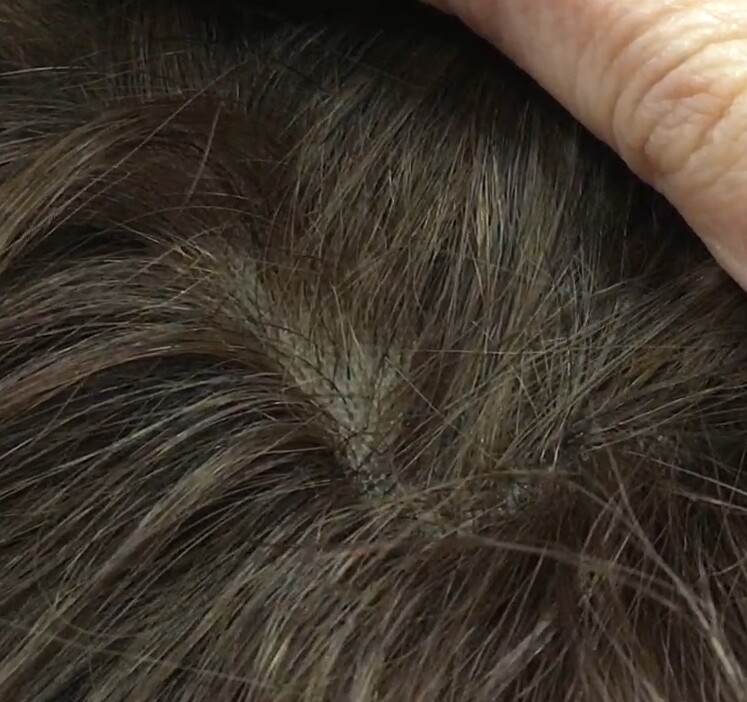 Peluca natural DONA Color 5 Top INYECCIN