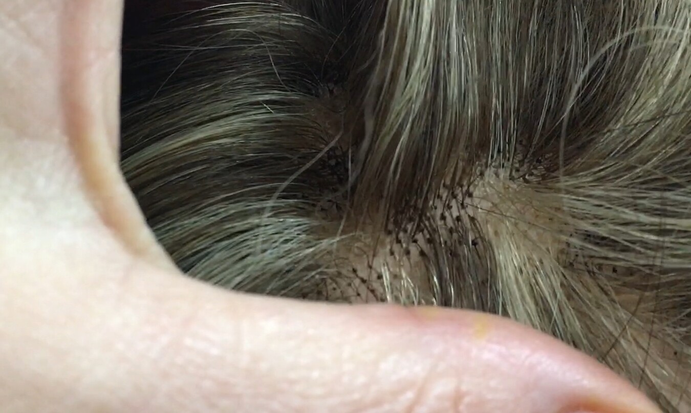 Peluca natural MELANIA TOP TUL color 4h18
