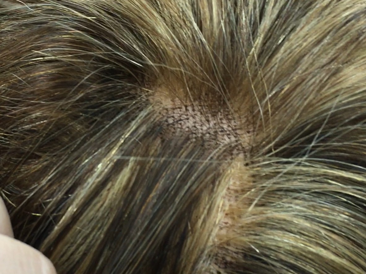 Peluca natural mod. MELANIA confeccion RAYA MEDIO TUL color 5H27