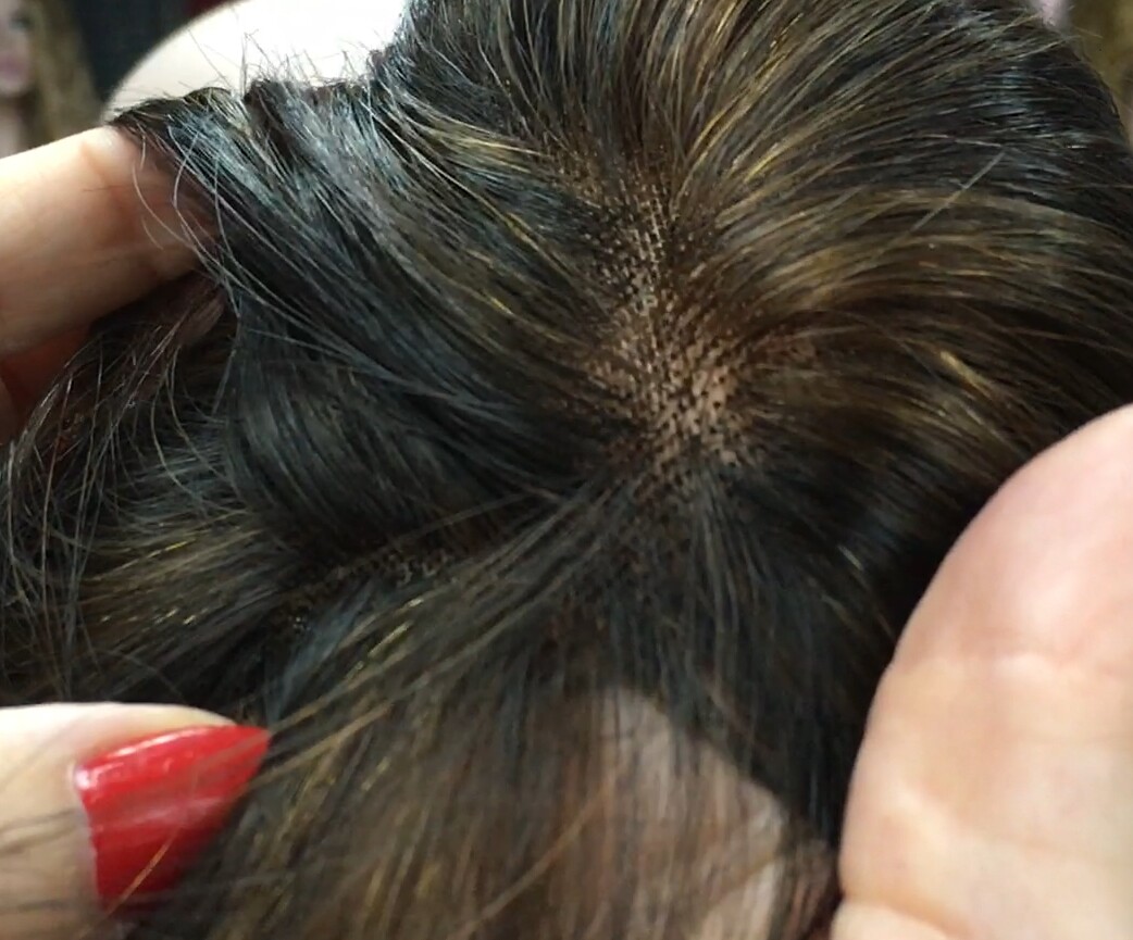 Protesis para alopecia diadema TOA 8 color 2h5