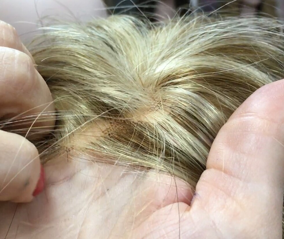 Protesis para alopecia diadema TOA 8 color 8h613