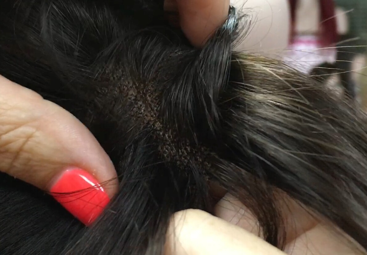 Protesis alopecia diadema TOA 4 MINI color 2 PEINADO HACIA DELANTE
