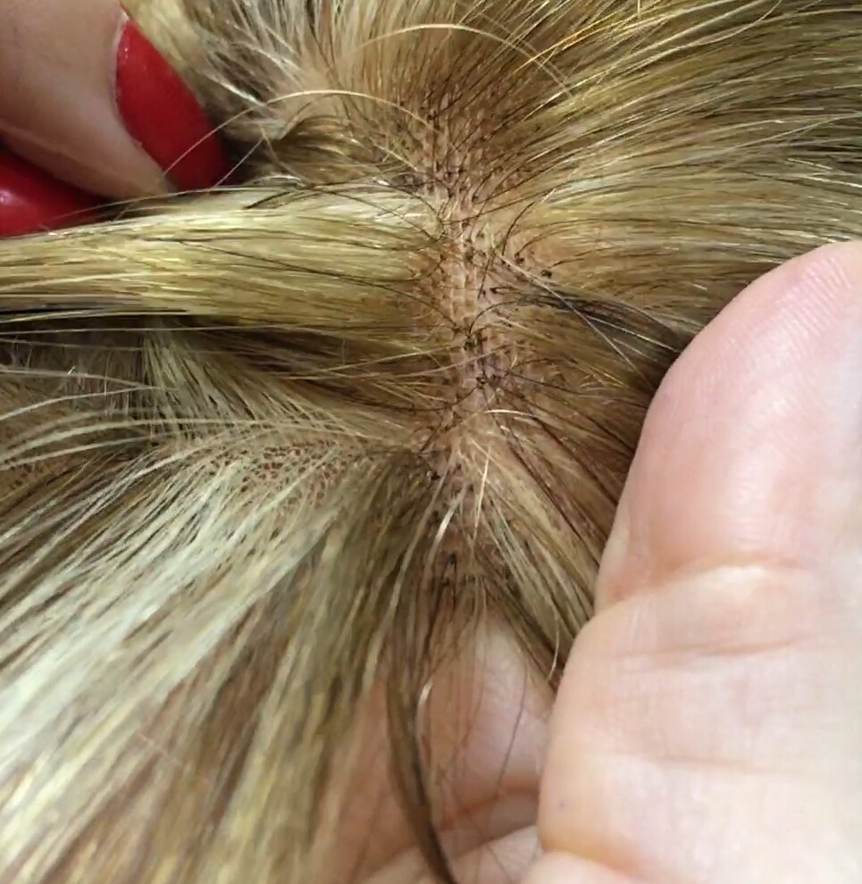 Protesis alopecia diadema TOA 4 MINI color 8H613 PEINADO HACIA DELANTE